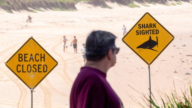 Shark attack in Sydney 