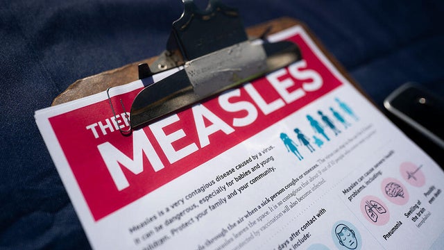 South Carolina Works To Contain Biggest US Measles Outbreak In Decades 