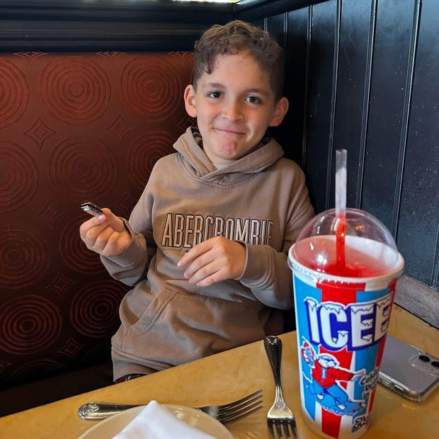 More kids are in ERs for tooth pain. Trump cuts and RFK Jr.’s anti-fluoride fight aren’t helping.