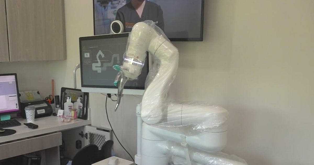cbsnews.com - Steve  Maugeri - Miami company develops robot to take guesswork out of dental surgery