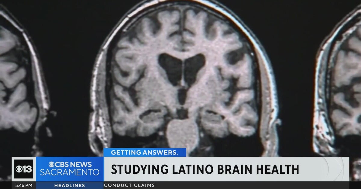 UC Davis awarded millions for Latino brain health study