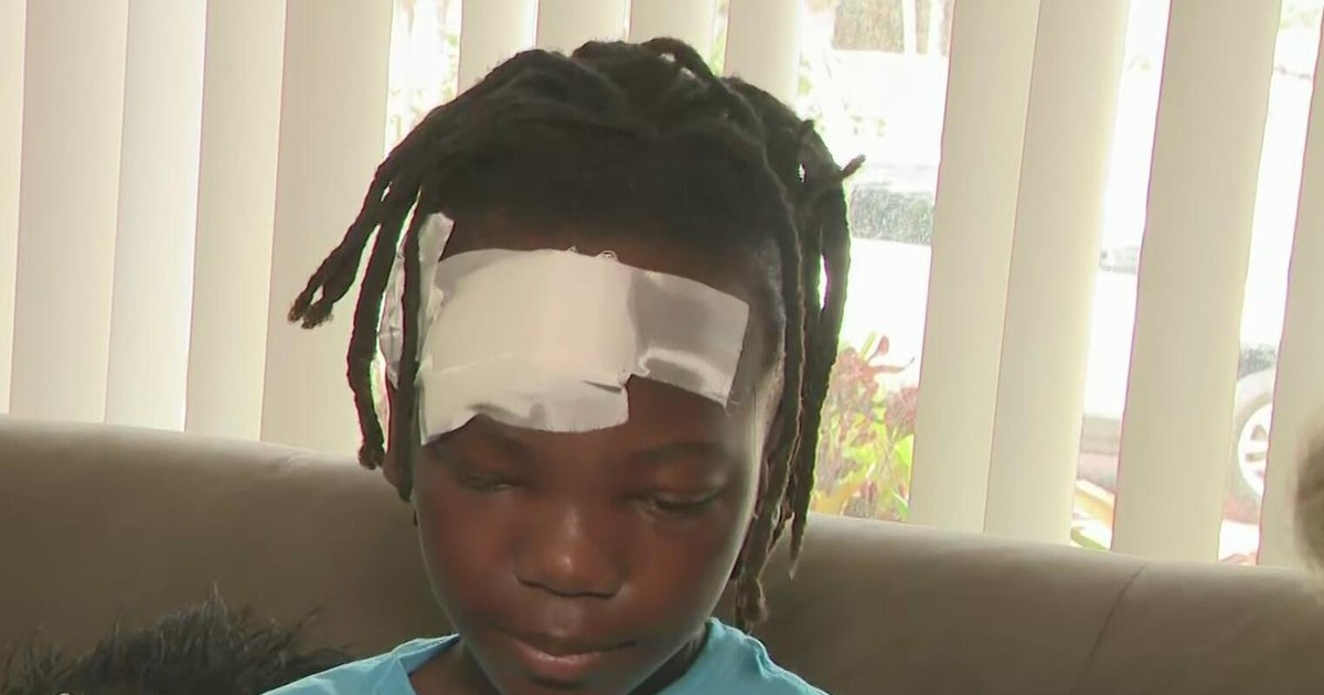 11-year-old boy recounts being hit by a speeding car while walking to school in Miami Gardens