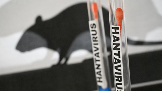 FRANCE-ILLUSTRATION-HANTAVIRUS 