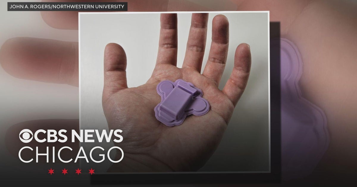 Wearable polygraph detects hidden stress - CBS Chicago