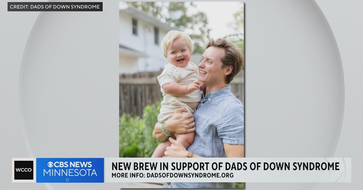 Dads of kids with Down syndrome built their own community after finding ...
