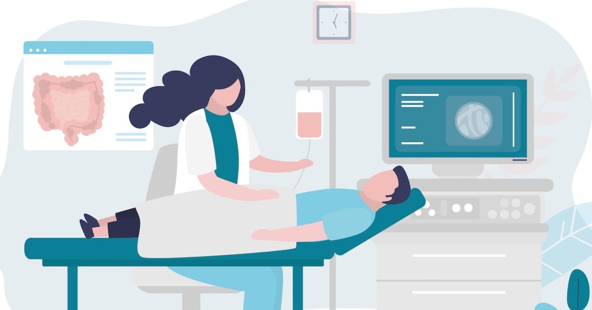 Breaking down the new colorectal cancer screening guidelines