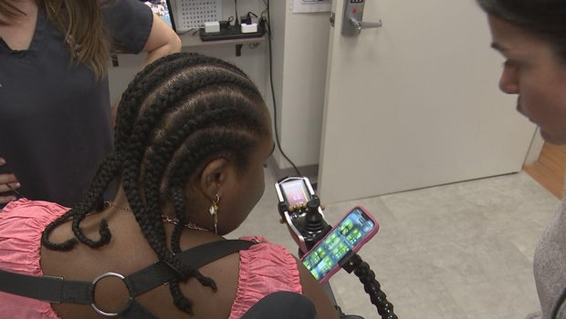 Philadelphia woman utilizes adaptive technology after losing limbs during COVID-19 battle