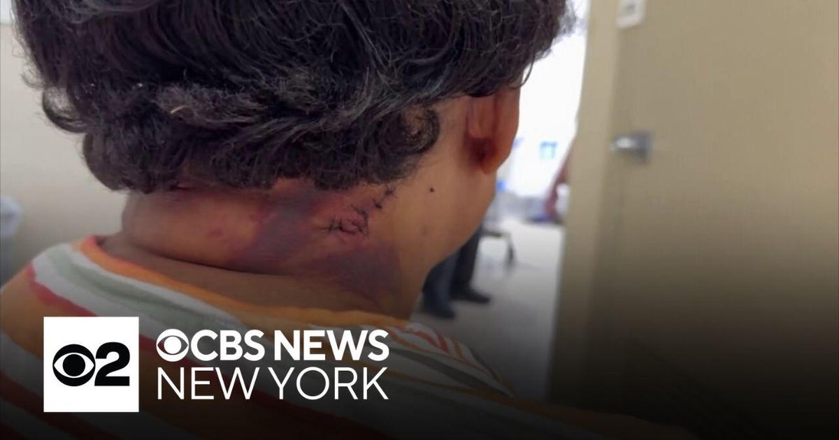 Man accused of randomly attacking 83-year-old woman on her way to ...