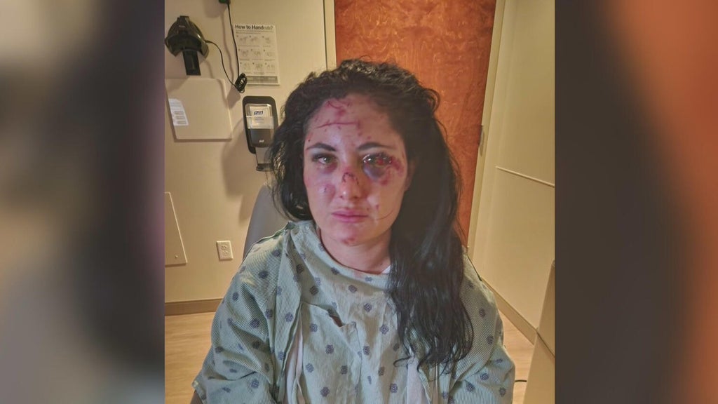 Downtown Miami assault survivor pushes for safety measures after random attack