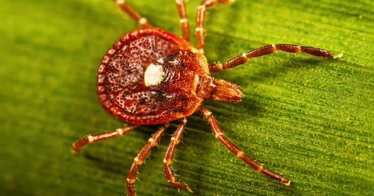 Tick season is expected to be worse than normal this summer. Here's why