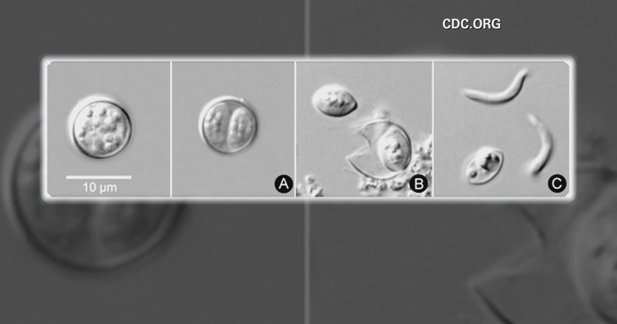 What is cyclosporiasis? Michigan health officials share what to know amid outbreak