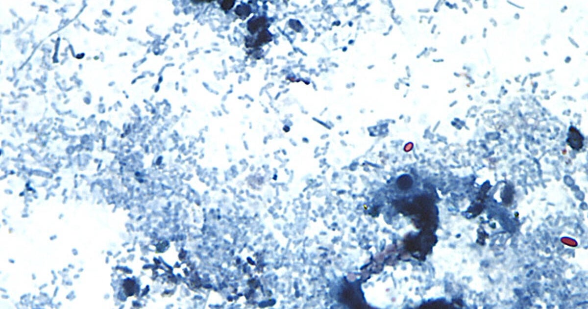 Diarrhea-causing parasite cyclospora sickens 11 in Allegheny County, officials say