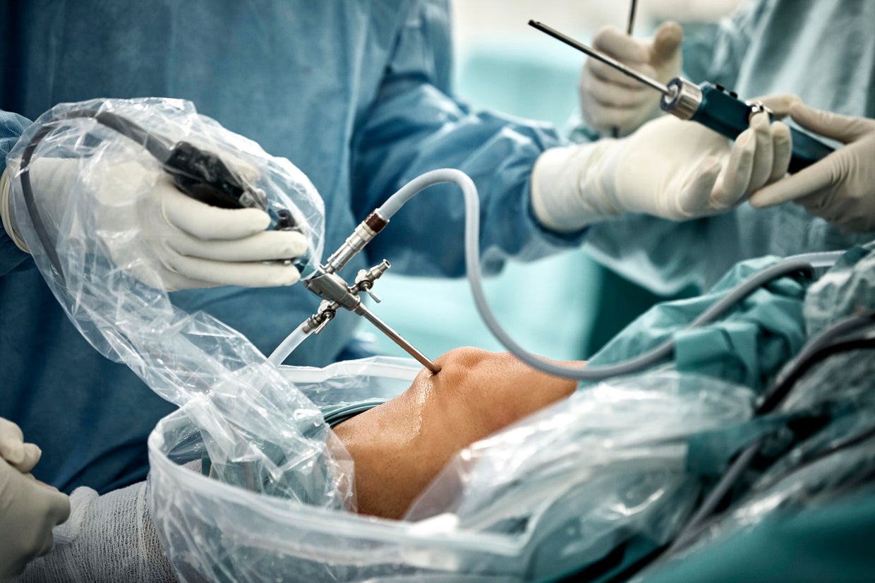 Common knee surgery may do more harm than good: 