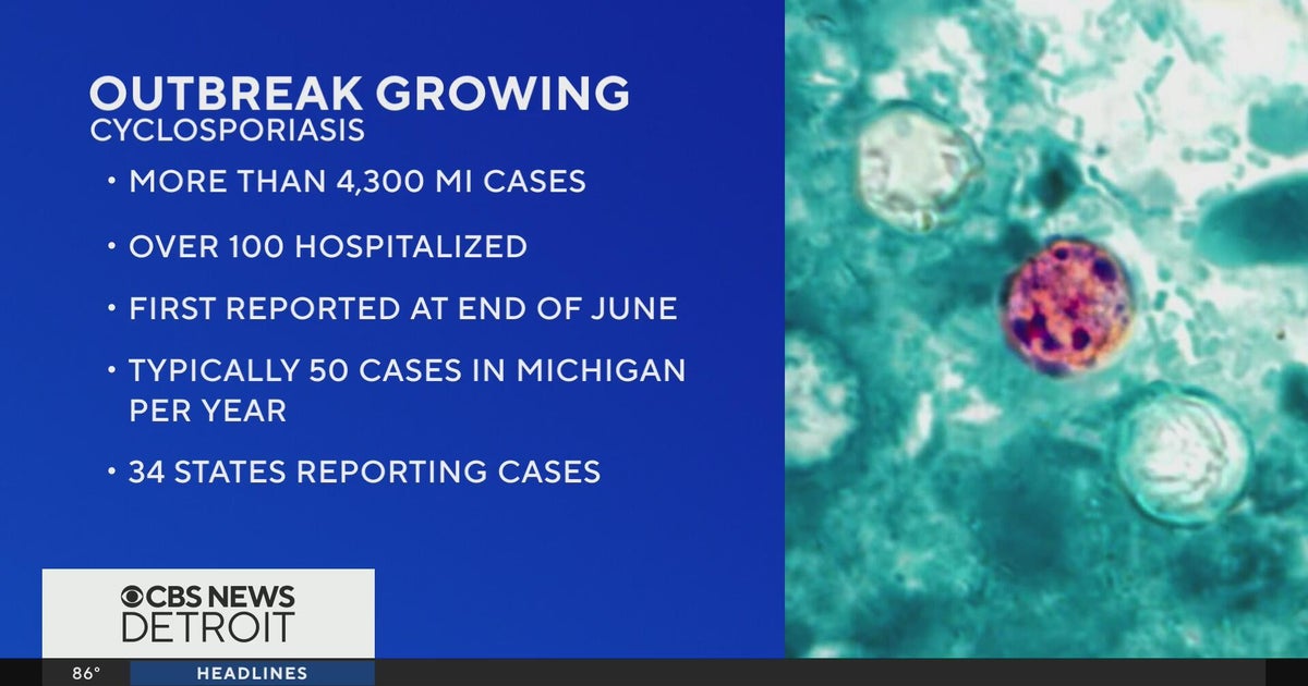 Michigan cyclosporiasis case numbers top 4,300