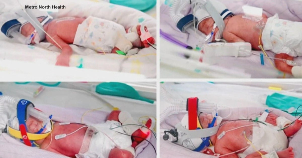 Australian woman gives birth to rare identical quadruplets