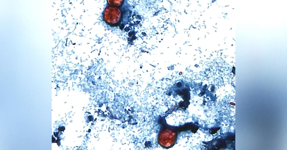 Research being done in Colorado examines how climate change may reshape disease risk, spread