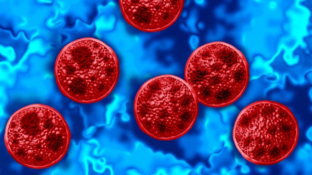 Cyclosporiasis outbreak 