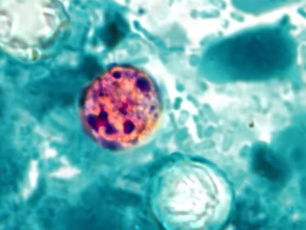 How Trump admin cuts have compromised food safety 2 cyclospora-cyclosporiasis-1280.jpg