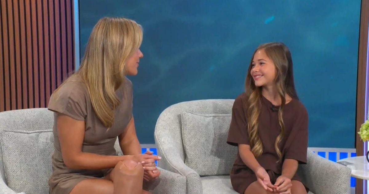 Paralympian surprises fellow shark attack survivor