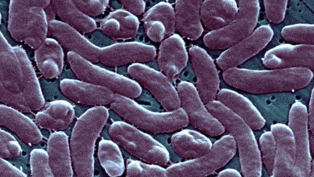 Vibrio Vulnificus 