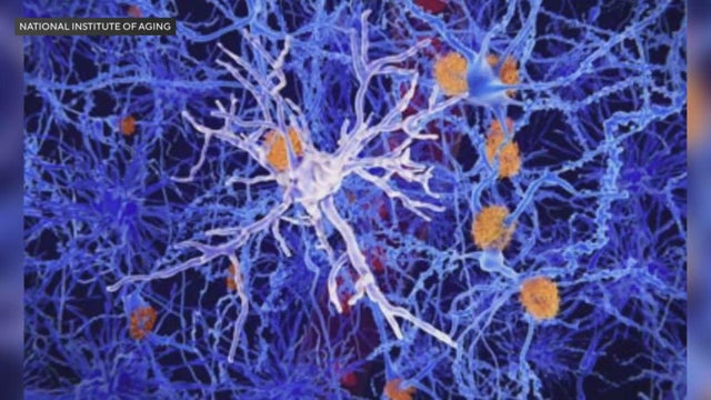 brain-health-1.jpg 