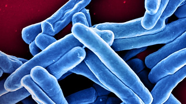 Mycobacterium tuberculosis bacteria 