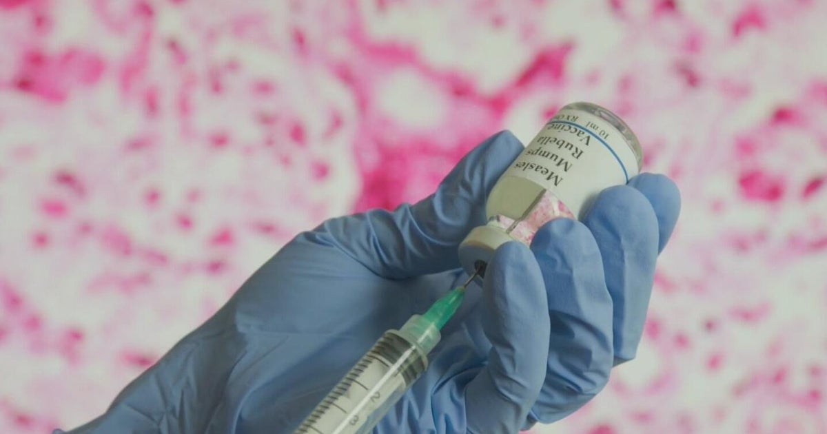 Political fight over measles leaves patients in the middle, doctors say