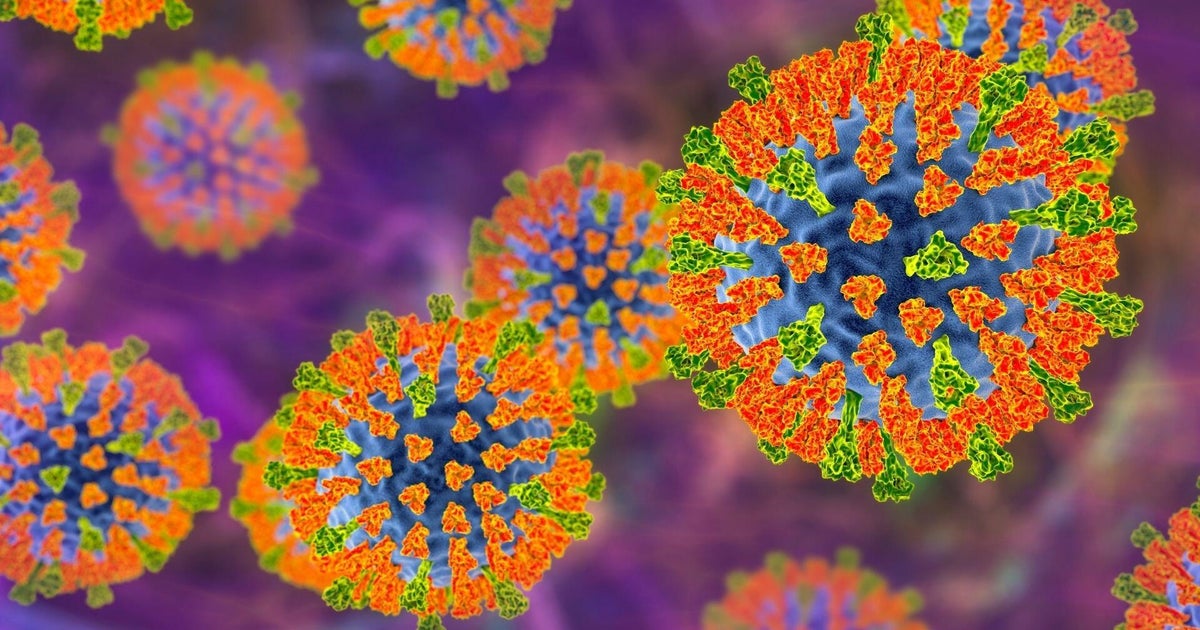What to know about the measles-related deaths in Pennsylvania
