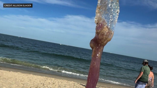nj-shore-jellyfish-stin-wcbsiwvl-hi-res-still-00-00-1410.jpg 