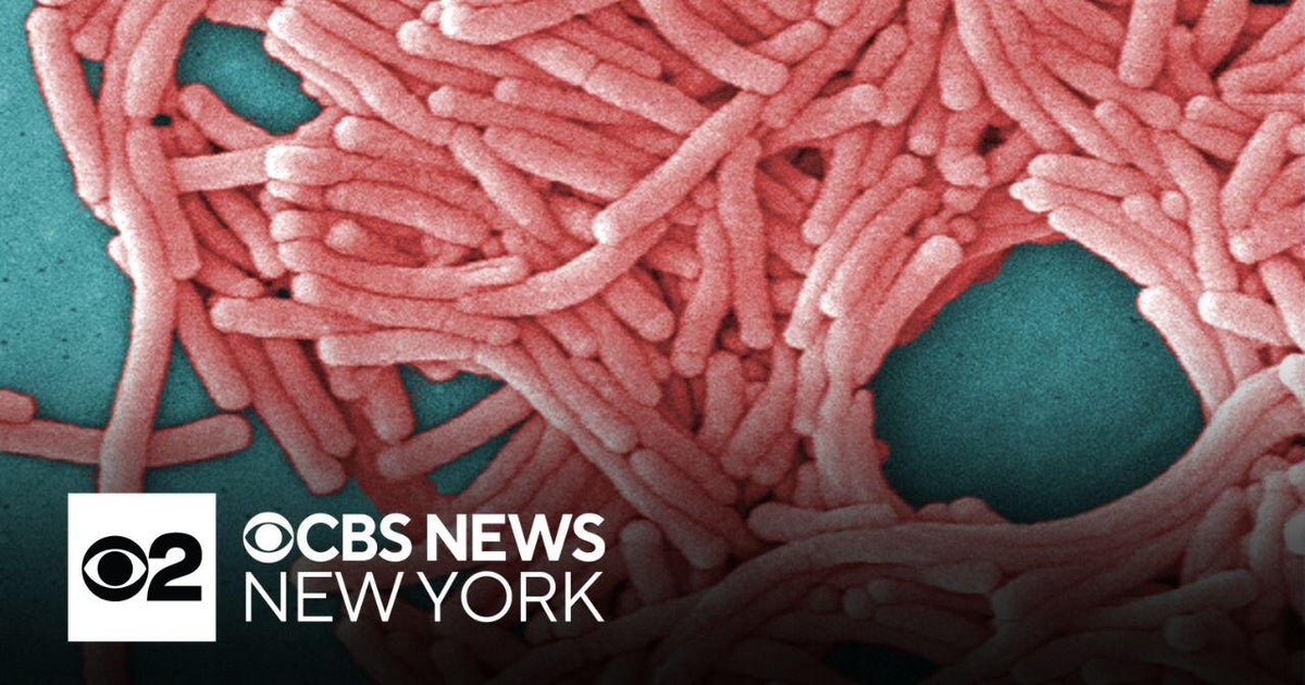 Bronx Legionnaires' disease cluster virtual town hall set for Sunday