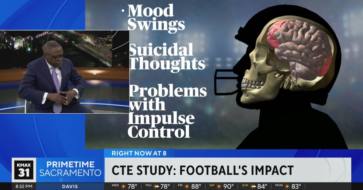CTE expert talks harrowing new study highlighting NFL players risk