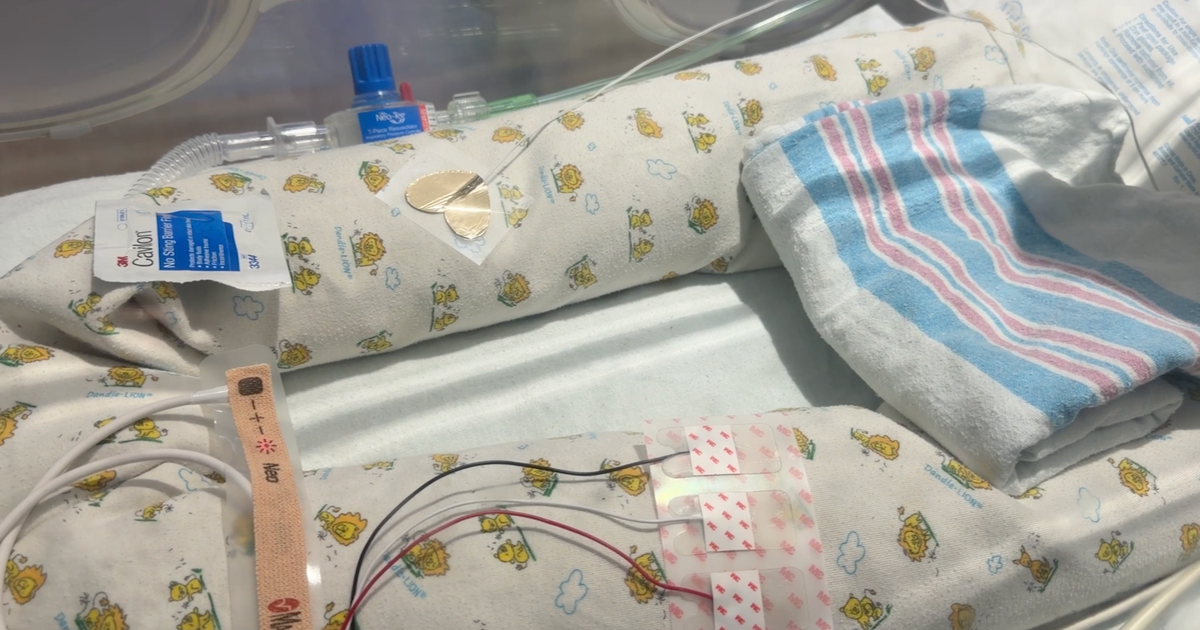 cbsnews.com - Hannah  Kliger - How a Brooklyn hospital is making the wait easier for NICU families