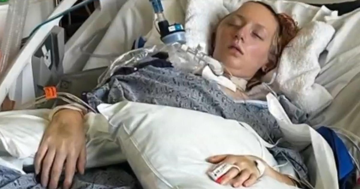 Six Flags' X2 roller coaster caused over 100 injuries, lawsuits say