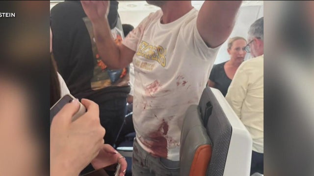 Dubai to Israel flight makes emergency landing