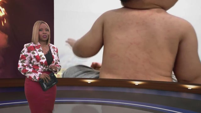 Trending Now: New Georgia measles cases, Macon shooting arrests, and more