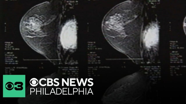 New research says women aren't doing enough to reduce risk of breast cancer