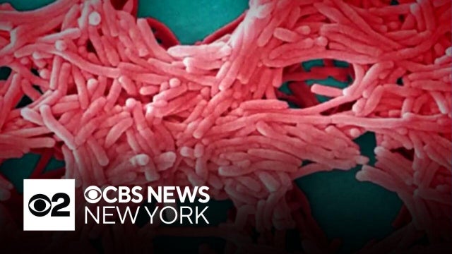 Legionnaires&rsquo; meeting held in Queens after 2 confirmed cases