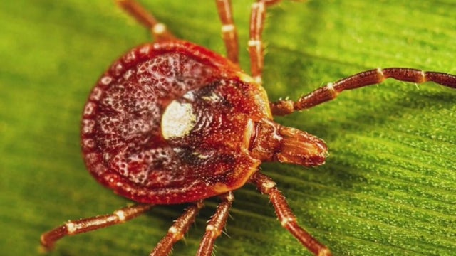 Pittsburgh-area woman diagnosed with alpha-gal syndrome after tick bite