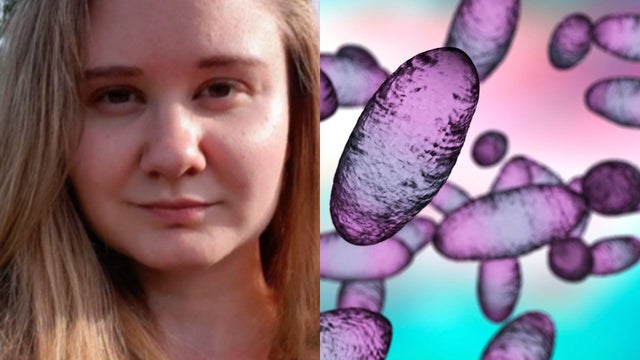 Russia downplays plague fears