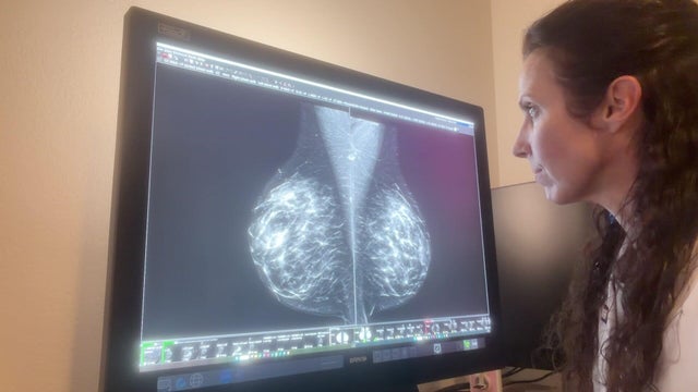 for-web-breast-cancer-screening.jpg 