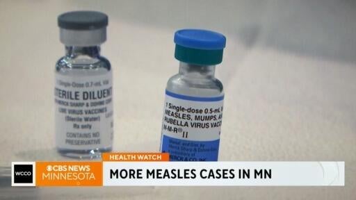 More measles cases in Minnesota, the latest on a foiled terror plot and other news headlines