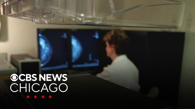 Endeavor Health joins Chicago Breast Cancer Research Consortium