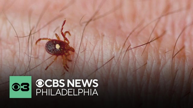 Doctors warn about growing concern about Alpha-gal syndrome