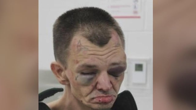 Inmate at jail allegedly severely beaten by corrections officers