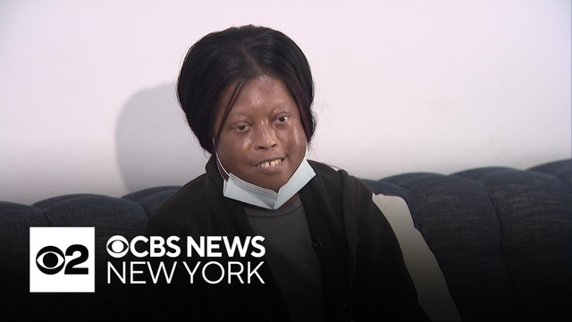 How CBS News New York viewers helped save a mom's life