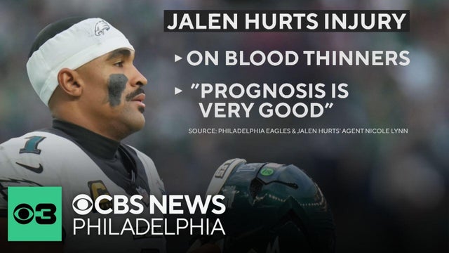 Eagles QB Jalen Hurts is among thousands every year diagnosed with blood clots in lungs