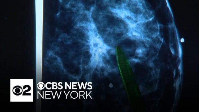 Breast cancer survivors say their challenges came at life-changing moments