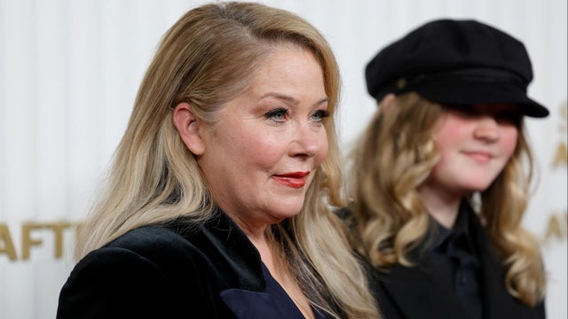More on Christina Applegate's MS misdiagnosis