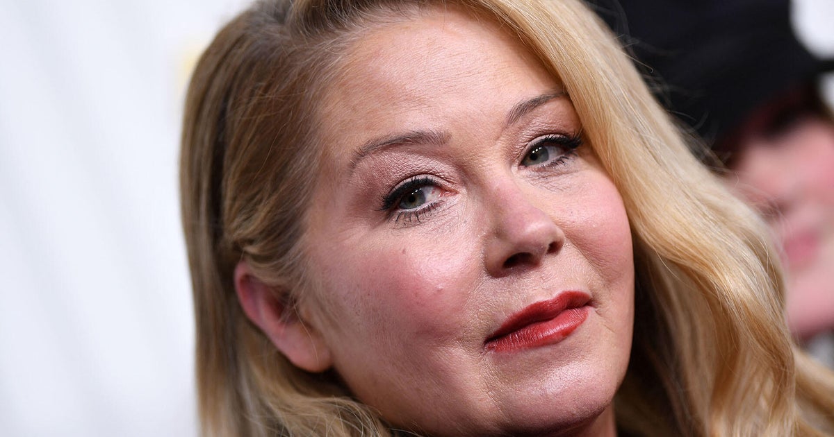 Doctor explains how a misdiagnosis of multiple sclerosis happens amid Christina Applegate news