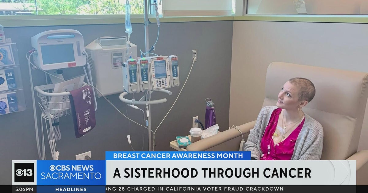 Rocklin woman talks importance of breast cancer screenings as cases rises in younger women